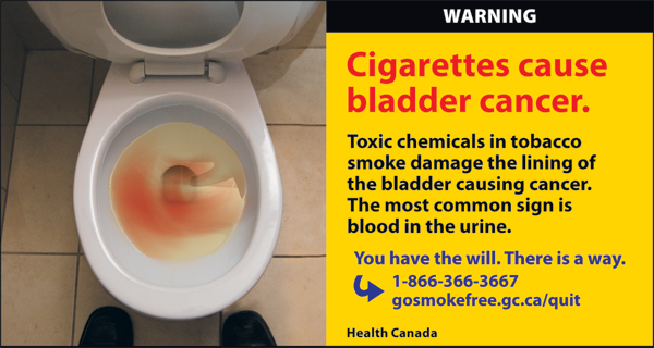 Canada 2012 Health Effects other - bladder cancer - eng